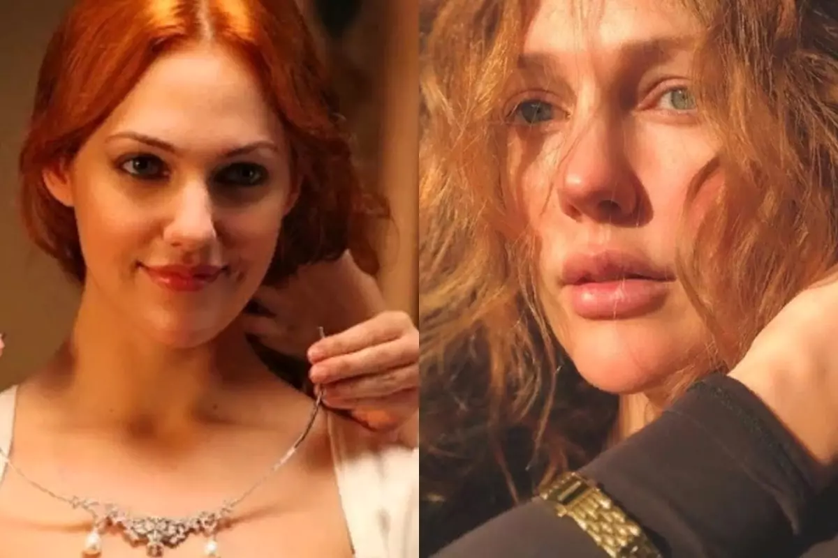 Large difference: 5 Turkish actresses before and after plastic