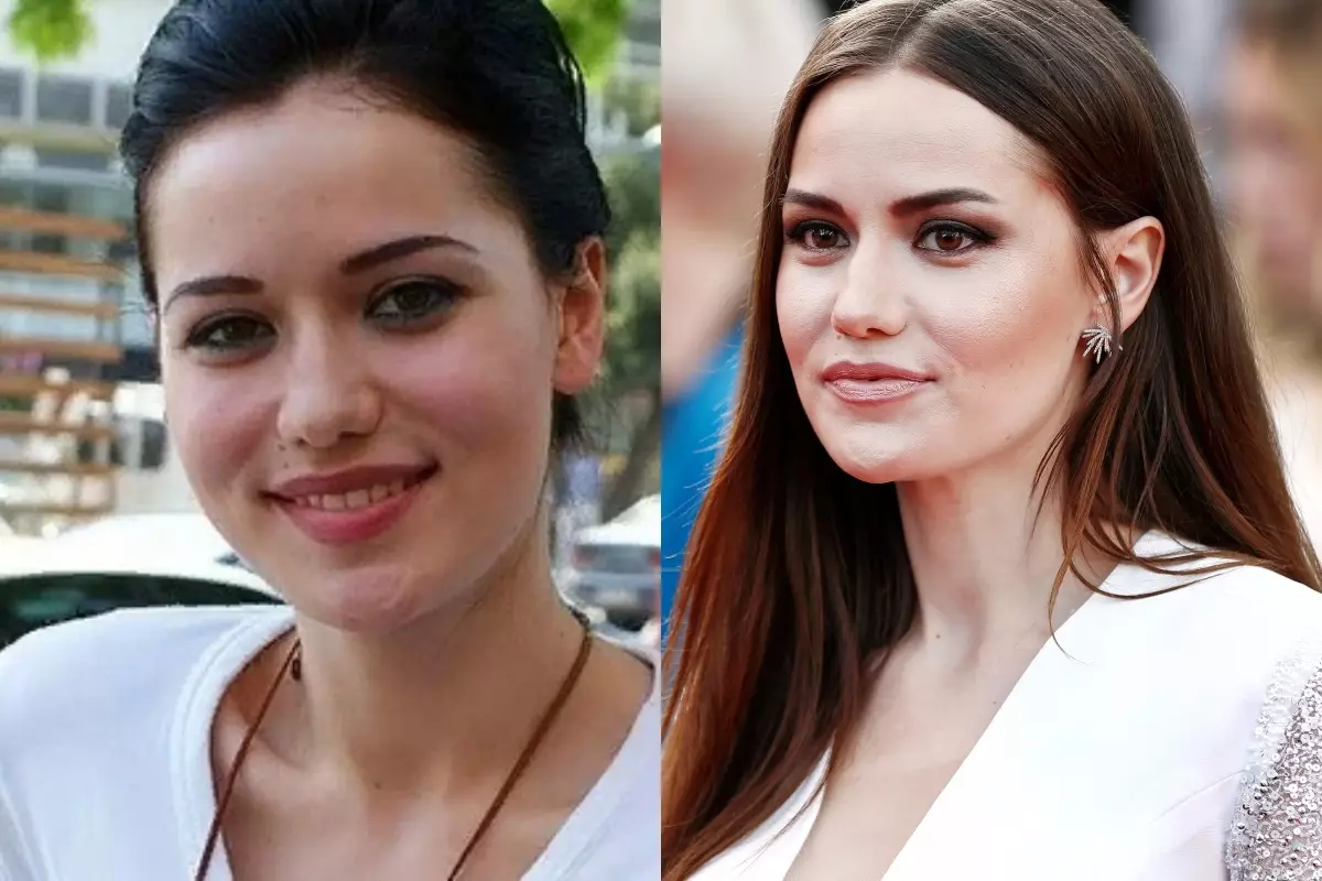 Perbezaan yang besar: 5 pelakon Turki sebelum dan selepas plastik 122002_1