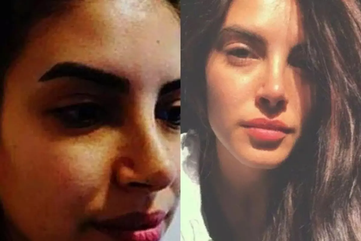 Grande diferença: 5 atrizes turcas antes e depois de plástico 122002_4