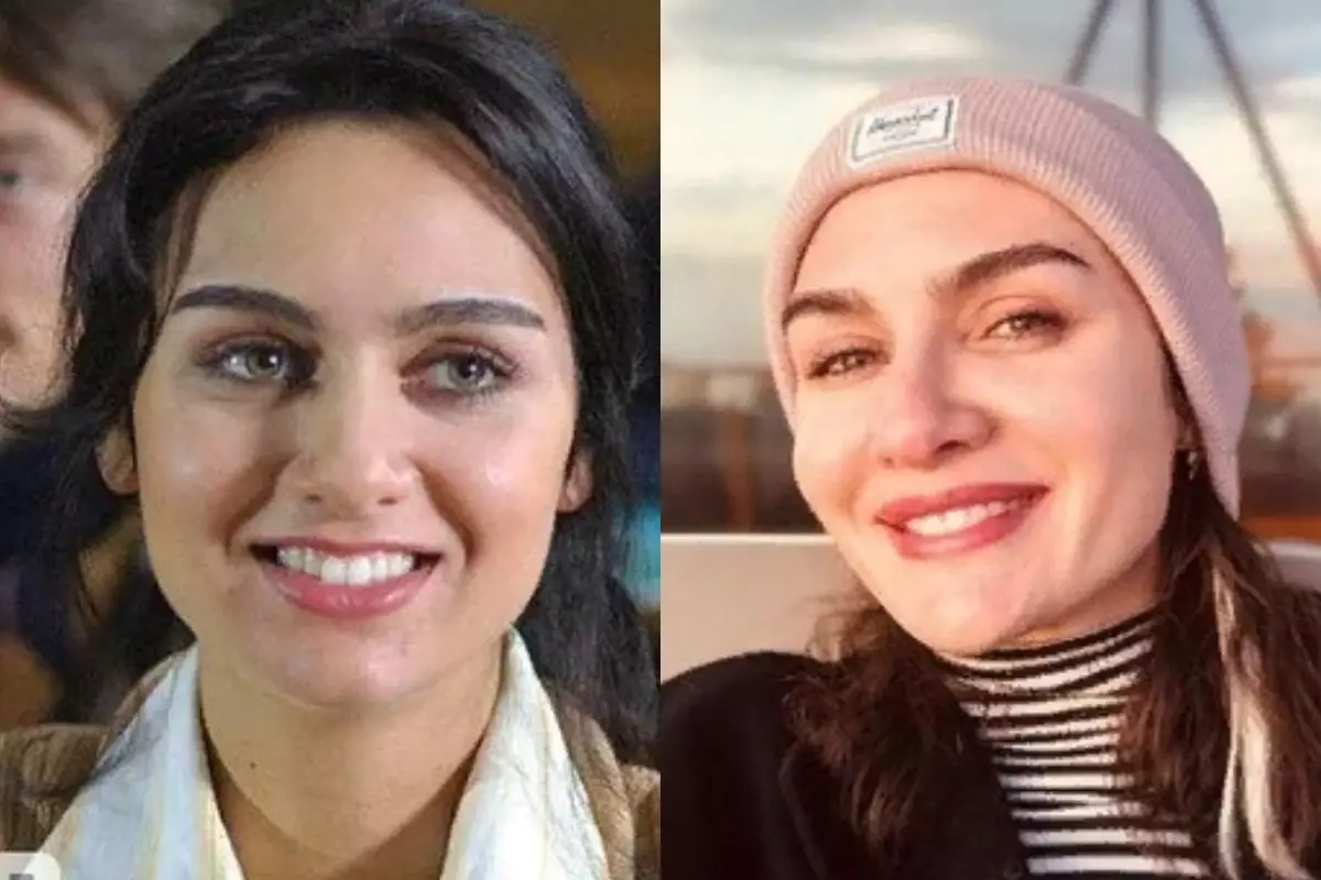 Malaking pagkakaiba: 5 Turkish actresses bago at pagkatapos ng plastic 122002_5