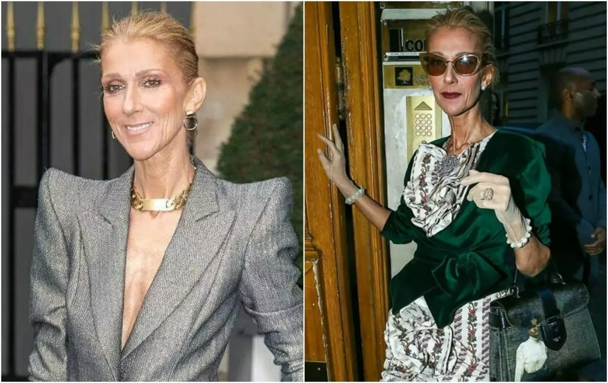 "Nechaj ma sám": Celine Dion silno odpovedal na každého, kto sa obáva, pretože jej nadmerné Hush