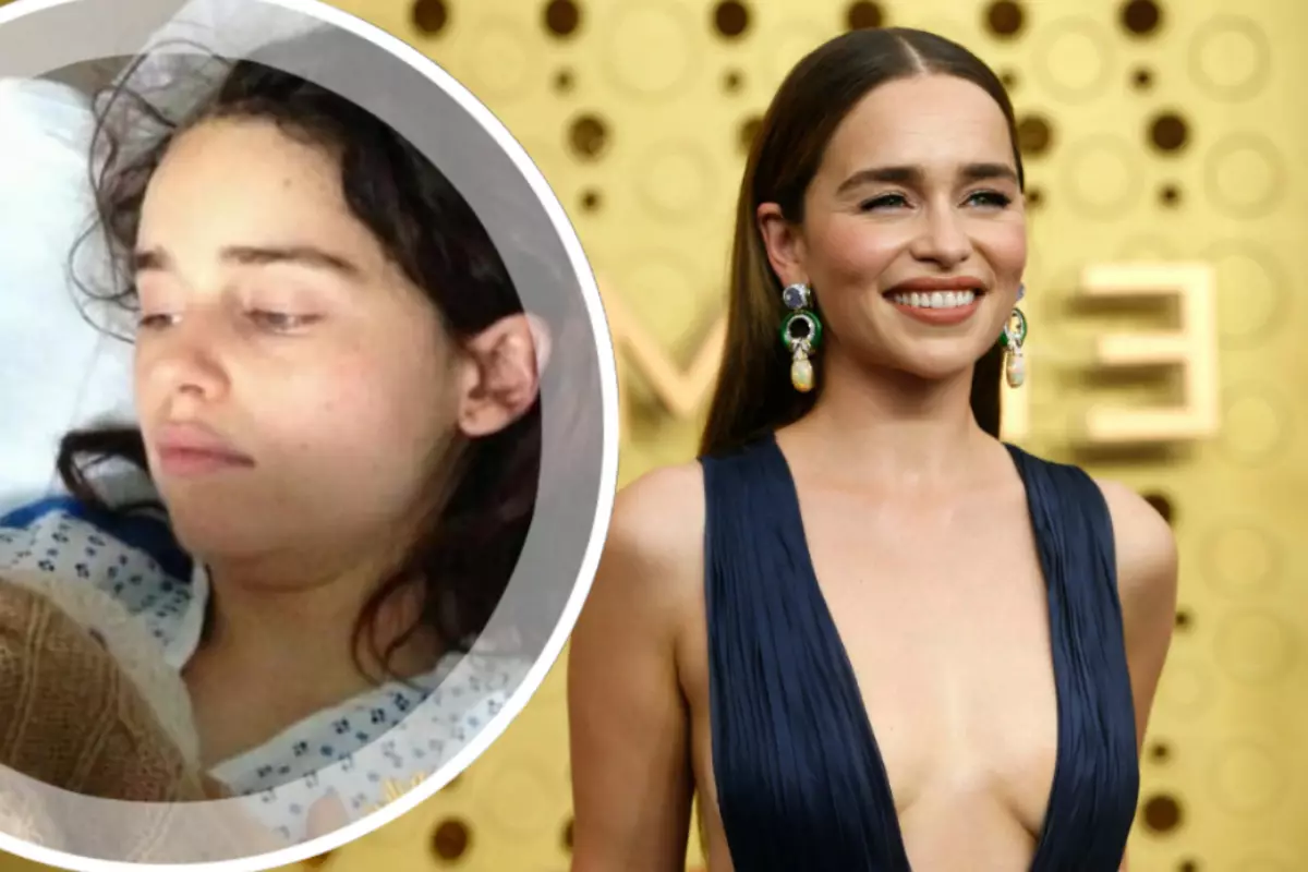 Emilia Clark angrer ikke at han har gjennomgått operasjoner på hjernen i 24 år