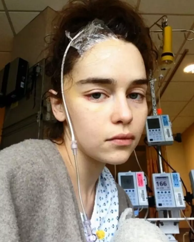 Emilia Clark takket Paramedikov fordi hun ble tvunget til å le mot sykehuset 29073_1