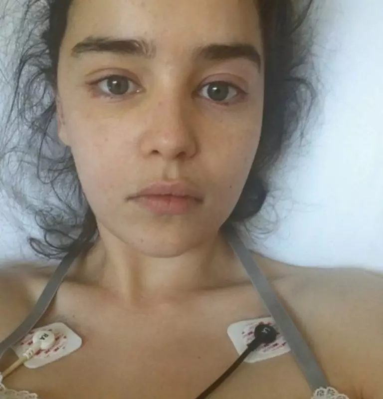 Emilia Clark သည်ဆေးရုံသို့ 0 င်ရောက်ရန်အတင်းအကျပ်ဖိအားပေးခံရသောကြောင့်ဖြစ်သည် 29073_2