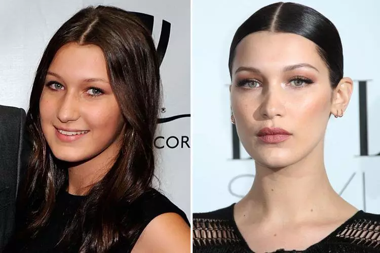 Ideal: Ahli bedah plastik mengenali wajah Bella Hadid yang paling indah di dunia 30026_2