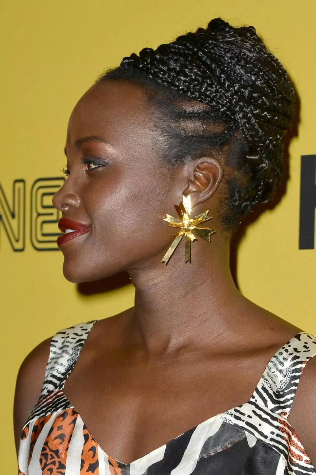 Lupita niongo بەك قېنىق تېرىسى سەۋەبىدىن يۈرۈشلۈكنى قوللانمىدى 30097_2