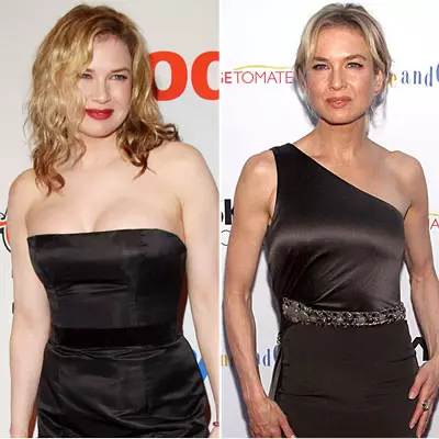 Estrellas perjudicables: Fotos de celebridades antes y después de la pérdida de peso. 46319_2